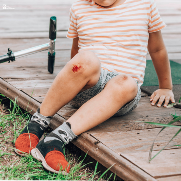Child sitting on a wooden deck with a scraped knee and nearby scooter, showing a common minor injury that highlights the need for family safety planning.